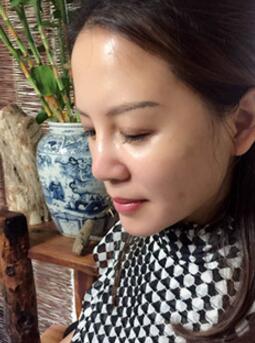 蛋白埋埋蛋白線.提升手術后恢復照片