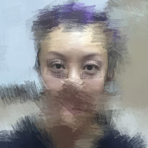 做了眼部電波l皮，一下子年輕了不少啊