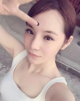 梨花雨隆鼻整形的恢復經(jīng)歷