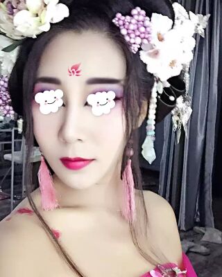 隆鼻失敗修復(fù)后整給鼻形很精致，鄭志敏醫(yī)生做的