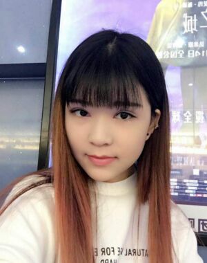全切雙眼皮修復后恢復成漂亮的眼睛了