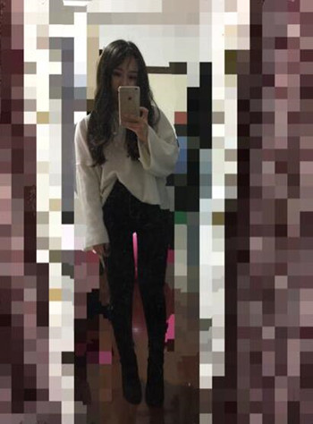 做了大腿吸脂手術(shù) 我的腿從大象腿變成螞蟻腿