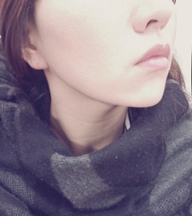 電波l皮緊膚除皺，的確是年輕了不少