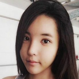 鷹鉤鼻矯正整形手術(shù)恢復(fù)過(guò)程和前后對(duì)比果圖片，分享給大家~