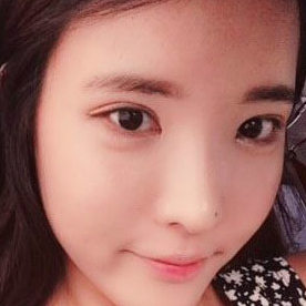 鷹鉤鼻矯正整形手術(shù)恢復(fù)過(guò)程和前后對(duì)比果圖片，分享給大家~