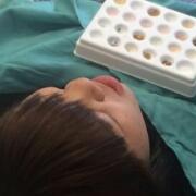 美容冠牙齒修復(fù)，緩解前后過(guò)程分享