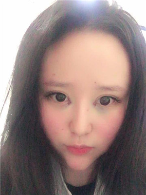 開了眼角之后，眼睛變得很勾人