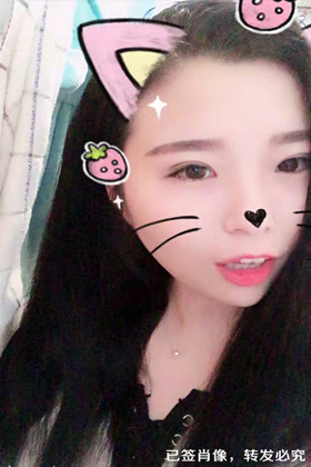 剛做了雙眼皮切開重瞼手術，恢復得越來越自然了