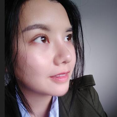 假體隆鼻兩個(gè)月后的感覺 隆鼻整形手術(shù)恢復(fù)日記