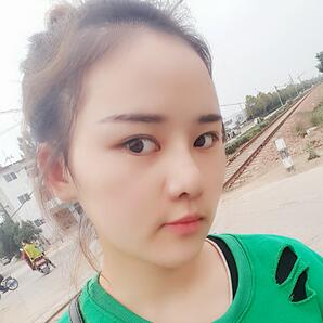 假體墊下巴一個(gè)月 前后對(duì)比