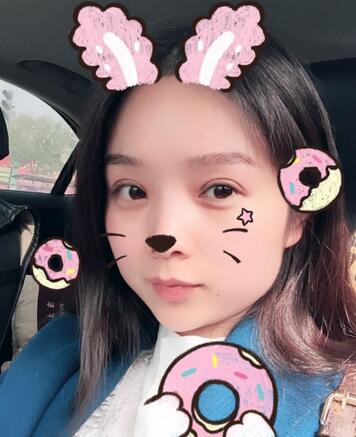 全切雙眼皮1個(gè)月過程圖