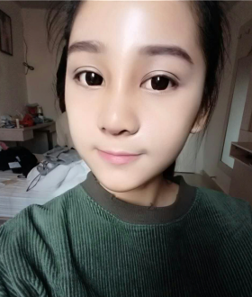 隆鼻整形日記，像變了個(gè)人似的