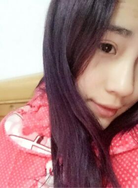 切開(kāi)雙眼皮恢復(fù)過(guò)程 真實(shí)經(jīng)歷分享一下