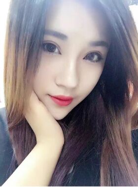 切開(kāi)雙眼皮恢復(fù)過(guò)程 真實(shí)經(jīng)歷分享一下