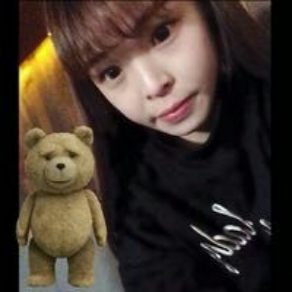 玻尿酸注射墊下巴和隆鼻前后對比果圖片分享，孫中生做的~