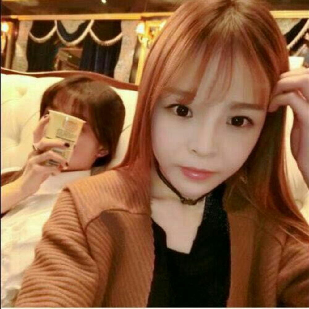 玻尿酸注射墊下巴和隆鼻前后對比果圖片分享，孫中生做的~