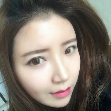 自體脂肪填充全臉1個月經(jīng)歷