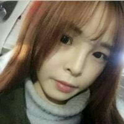 玻尿酸注射隆鼻三個(gè)月了，分享術(shù)后恢復(fù)照片哇~