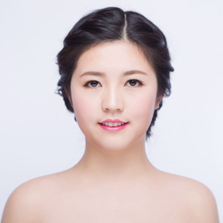 激光去雀斑前后對(duì)比果圖片分享，福州海峽林瓏醫(yī)生做的~