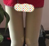 今年去做了大腿吸脂減肥手術(shù)，吸脂果挺好的