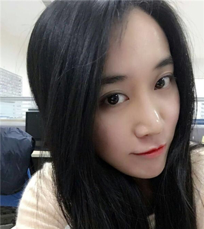硅膠假體隆鼻手術(shù)恢復(fù)過程分享，還有前后對比果圖片哦~