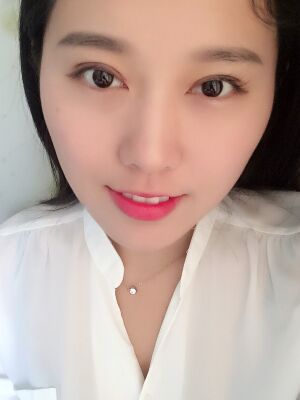 雙眼皮失敗修復(fù)手術(shù)恢復(fù)超自然，看起來一點(diǎn)都不假