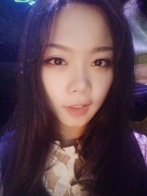全切雙眼皮手術(shù)，送給自己的成年禮物