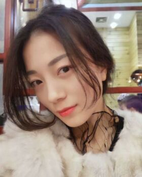 激光去眼袋成好嗎，看看我就知道啦