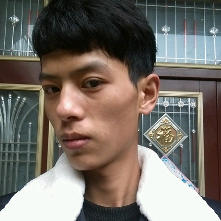 內(nèi)切去眼袋+切開割雙眼皮恢復(fù)過程和前后對比果圖片分享哦~