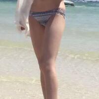 大腿吸脂減肥整形恢復(fù)經(jīng)歷分享，吸脂果不錯(cuò)