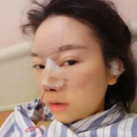 鼻子整形價(jià)格10000元，隆鼻手術(shù)過程圖分享