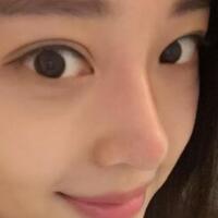 為什么大家覺得隆鼻恐怖，我就做了玻尿酸隆鼻，過程經(jīng)歷分享