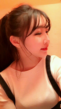 顴骨整形手術(shù)后，我也可以擁有精致小臉了