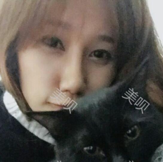 膨體隆鼻后我也有了像明星那樣的小翹鼻了