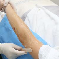 從小我就毛發(fā)旺盛，做了激光脫毛果圖分享給大家