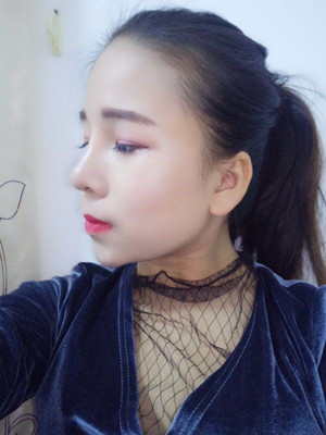 廣州廣美做的假體隆鼻，給大家分享一下手術(shù)前后過程以及對比照片