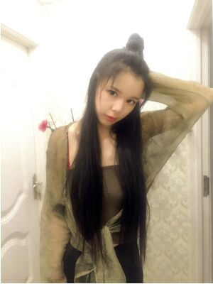 詳細(xì)部自體脂肪填充基本恢復(fù)照片