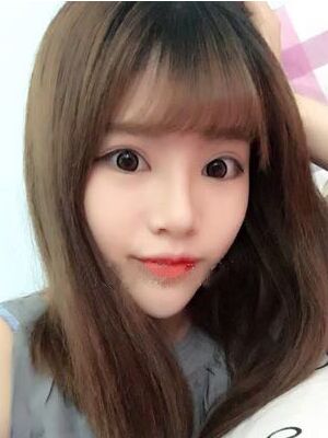 耳軟骨墊鼻尖+硅膠假體隆鼻前后對(duì)比，變化是不是很大