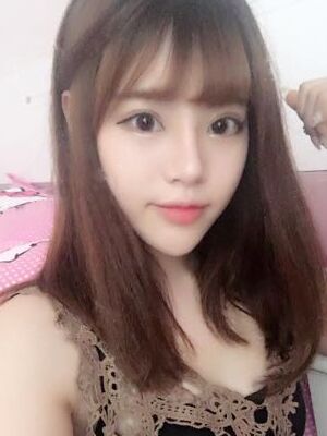 耳軟骨墊鼻尖+硅膠假體隆鼻前后對(duì)比，變化是不是很大