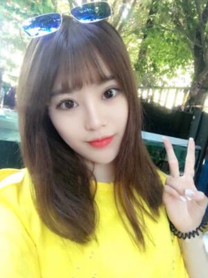 耳軟骨墊鼻尖+硅膠假體隆鼻前后對(duì)比，變化是不是很大