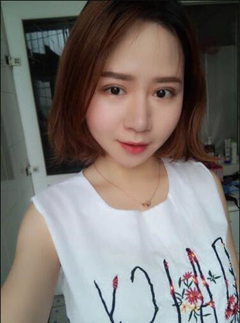 大鼻子就得做隆鼻整形手術(shù)改良 我的果就挺不錯(cuò)的