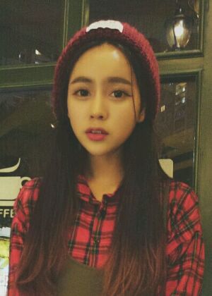 自體脂肪豐額頭+蘋果肌恢復(fù)兩個(gè)月照片分享