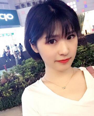 微創(chuàng)定點(diǎn)每天恢復(fù)過程圖 北京麗星雙眼皮3個月