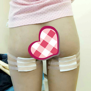大腿吸脂，我也可以擁有小細(xì)腿