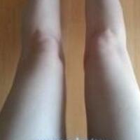 水動力吸脂減肥瘦大腿真實經(jīng)歷，抽脂后對比照片分享