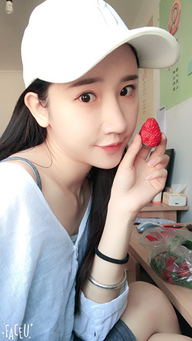 56000元做的自體脂肪填充蘋果肌+太陽穴，大家來看看果怎么樣