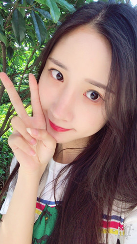 56000元做的自體脂肪填充蘋果肌+太陽穴，大家來看看果怎么樣