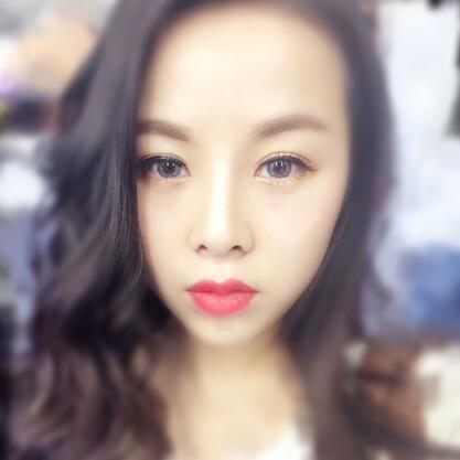 耳軟骨墊鼻尖+隆鼻+鼻翼縮小3個(gè)月了