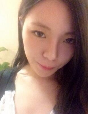 隆鼻整形真實(shí)恢復(fù)期圖片 硅膠隆鼻+鼻頭縮小