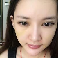 面部面b提升恢復日記和恢復圖片，一周左右恢復自然